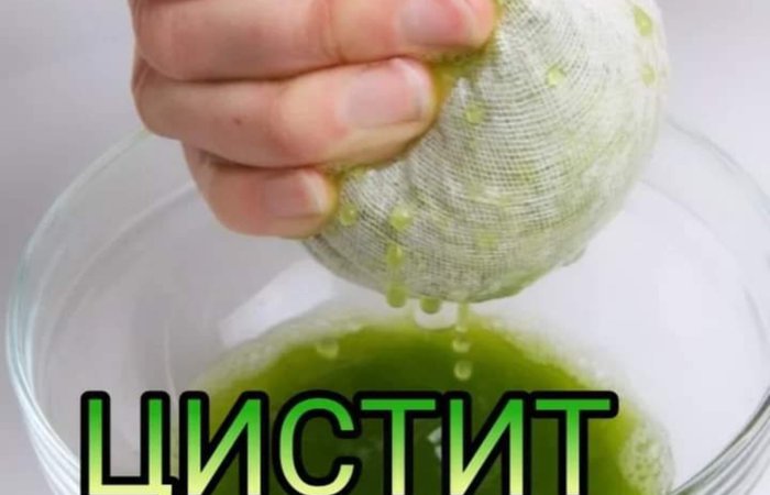 Цистит